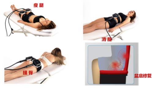 瘦腰、翘臀、瘦大腿,fotona4D兄弟:fotona星丽人增肌减脂王疗效翻倍