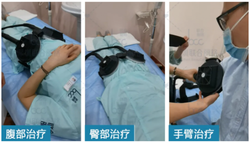 瘦腰、翘臀、瘦大腿,fotona4D兄弟:fotona星丽人增肌减脂王疗效翻倍