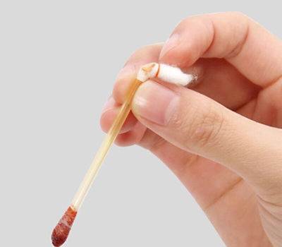 当身体出现伤口可以用碘伏消毒吗